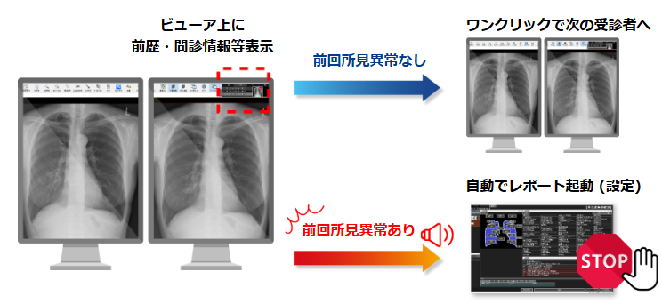 PAXiS-Screeningの機能：前回結果・問診情報をビューア上に表示